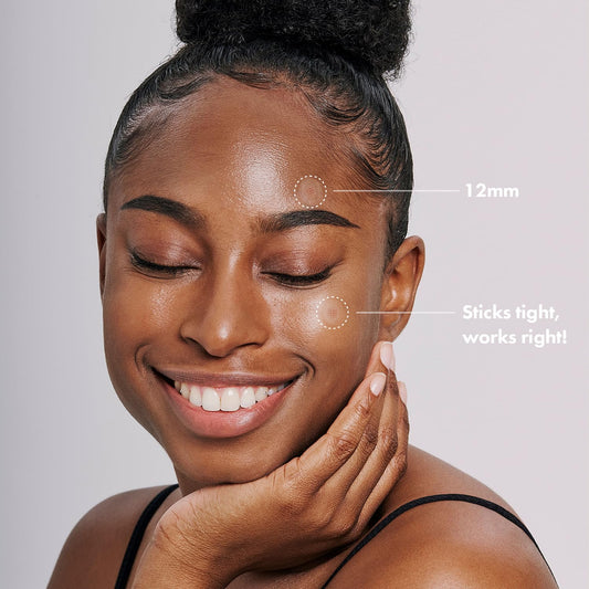 Acropass Trouble Care Microcone Acne Patch for Early Stage Pimple and Zits - Hydrocolloid, Niacimide Pimple Spot Treatment