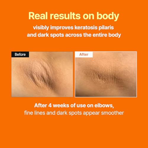 MEDITHERAPY Retinal Skin Booster Serum – Daily Retinal 100ppm for Beginners, Non-Irritating Retinol for Face & Body – Pore Minimizer, Wrinkle Treatment, Glass Skin – Korean Skin Care, Large Size (150ml)