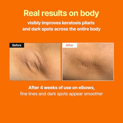 MEDITHERAPY Retinal Skin Booster Serum – Daily Retinal 100ppm for Beginners, Non-Irritating Retinol for Face & Body – Pore Minimizer, Wrinkle Treatment, Glass Skin – Korean Skin Care, Large Size (150ml)