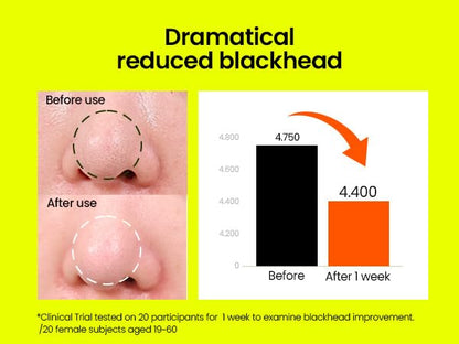 beplain Mung Bean Cleansing Oil | Oil Cleanser For Face, Makeup, Blackhead Remover, Korean Skin Care | deep cleansing oil for Sensitive & Dry skin