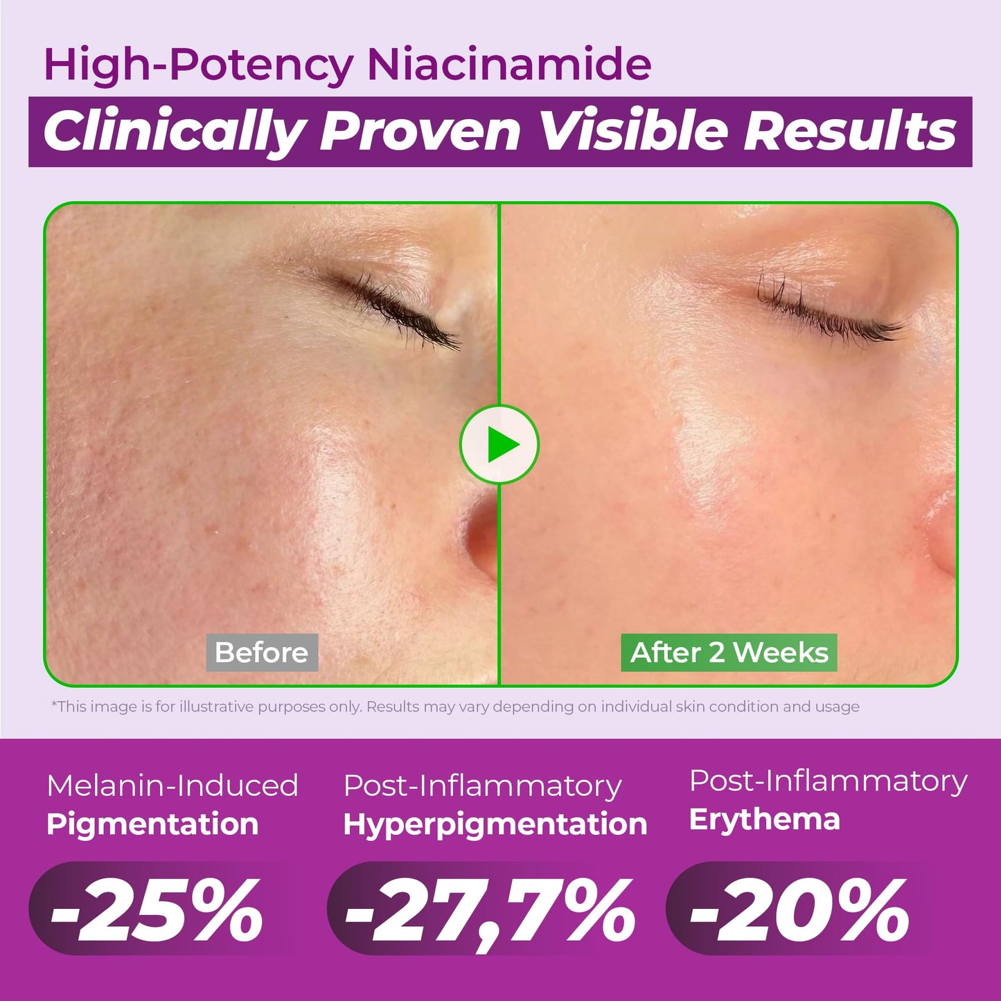 JUMISO Niacinamide Serum