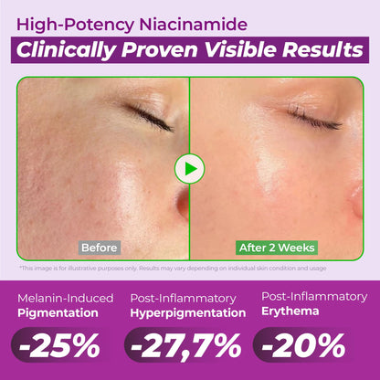 JUMISO Niacinamide Serum
