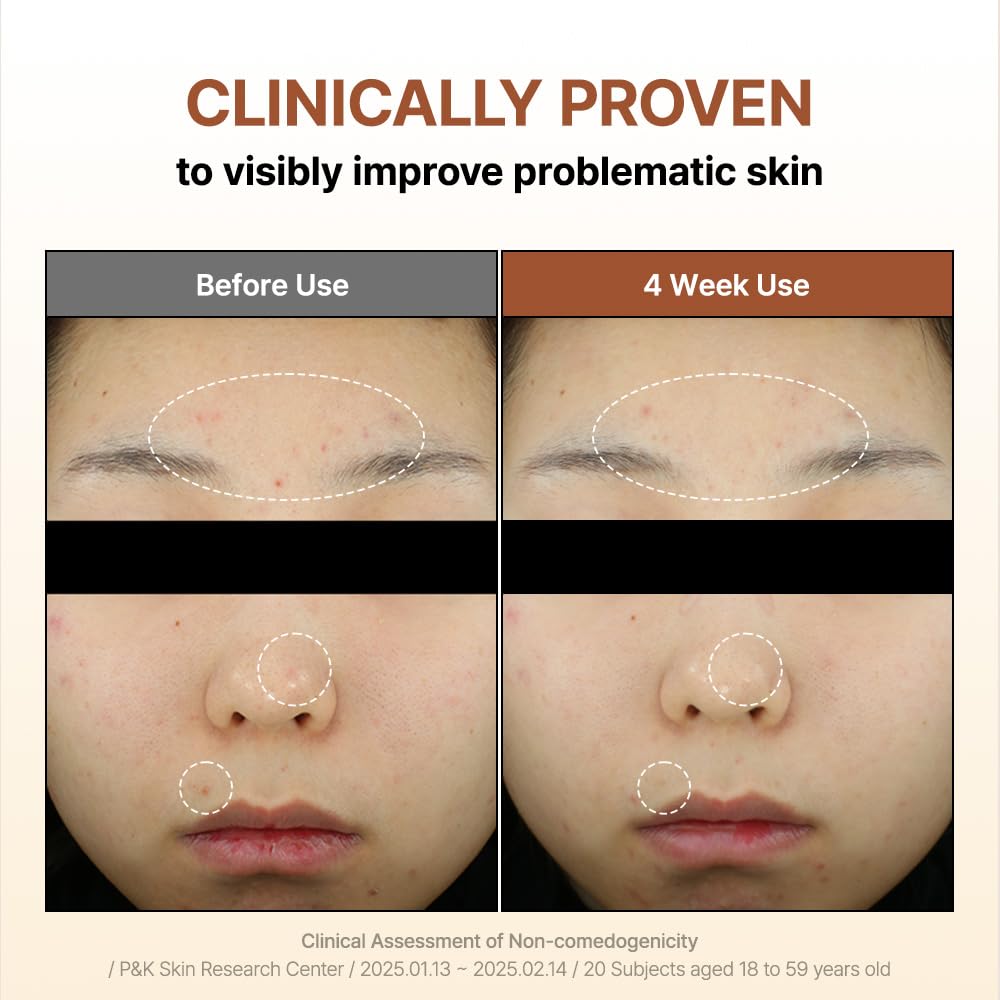 [BY WISHTREND] Mandelic Acid 5% Skin prep Water, Gentle Skin exfoliator for face, Aha Bha Toner, Ideal for Sensitive Skin | Helping clogged pores and Pigmentation