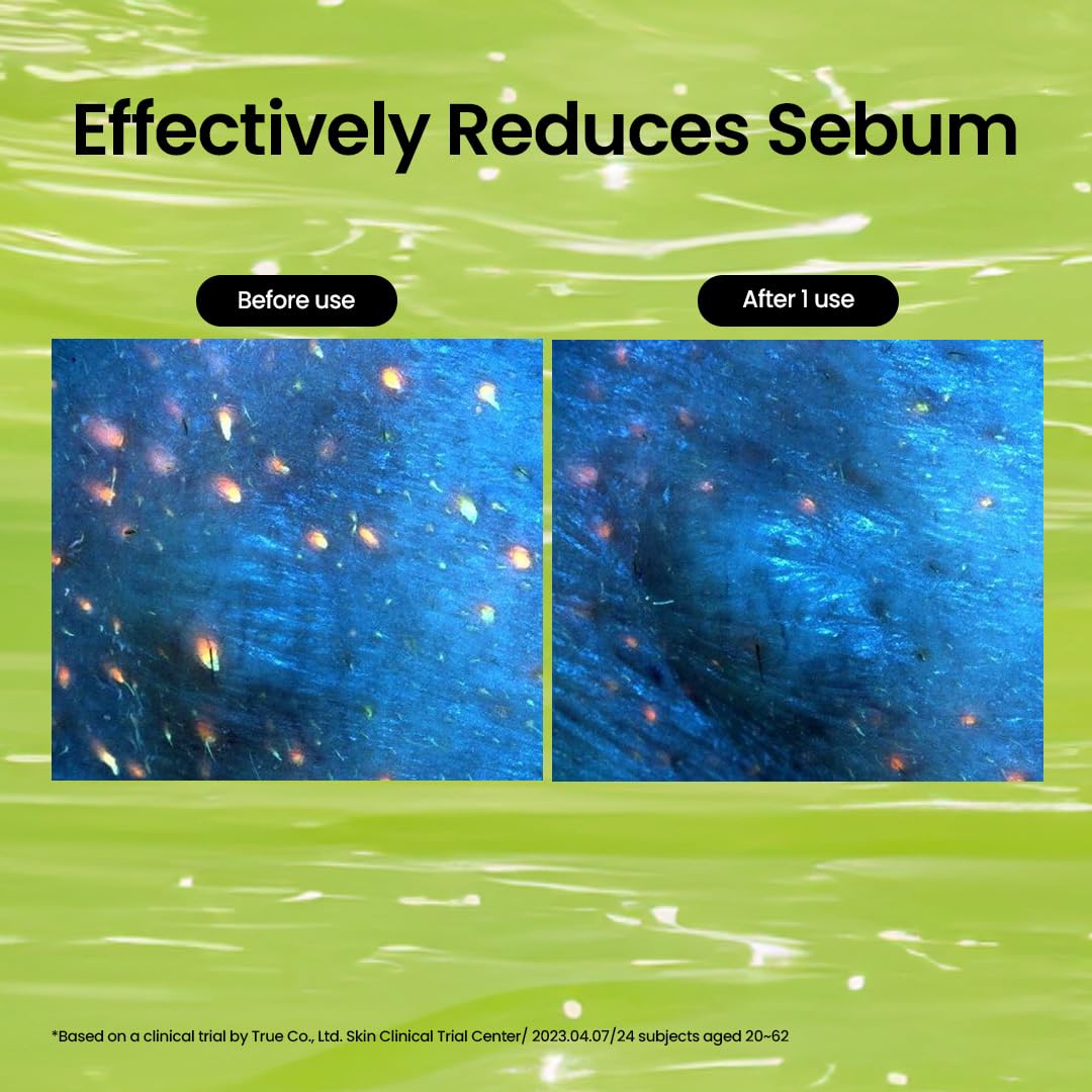 beplain Mung Bean Cleansing Oil | Oil Cleanser For Face, Makeup, Blackhead Remover, Korean Skin Care | deep cleansing oil for Sensitive & Dry skin