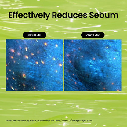 beplain Mung Bean Cleansing Oil | Oil Cleanser For Face, Makeup, Blackhead Remover, Korean Skin Care | deep cleansing oil for Sensitive & Dry skin