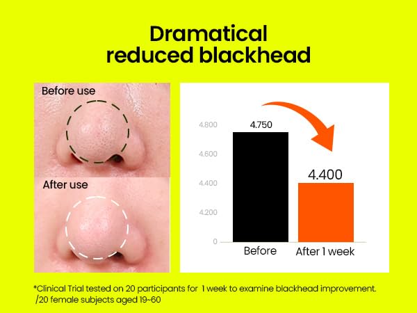 beplain Mung Bean Cleansing Oil | Oil Cleanser For Face, Makeup, Blackhead Remover, Korean Skin Care | deep cleansing oil for Sensitive & Dry skin