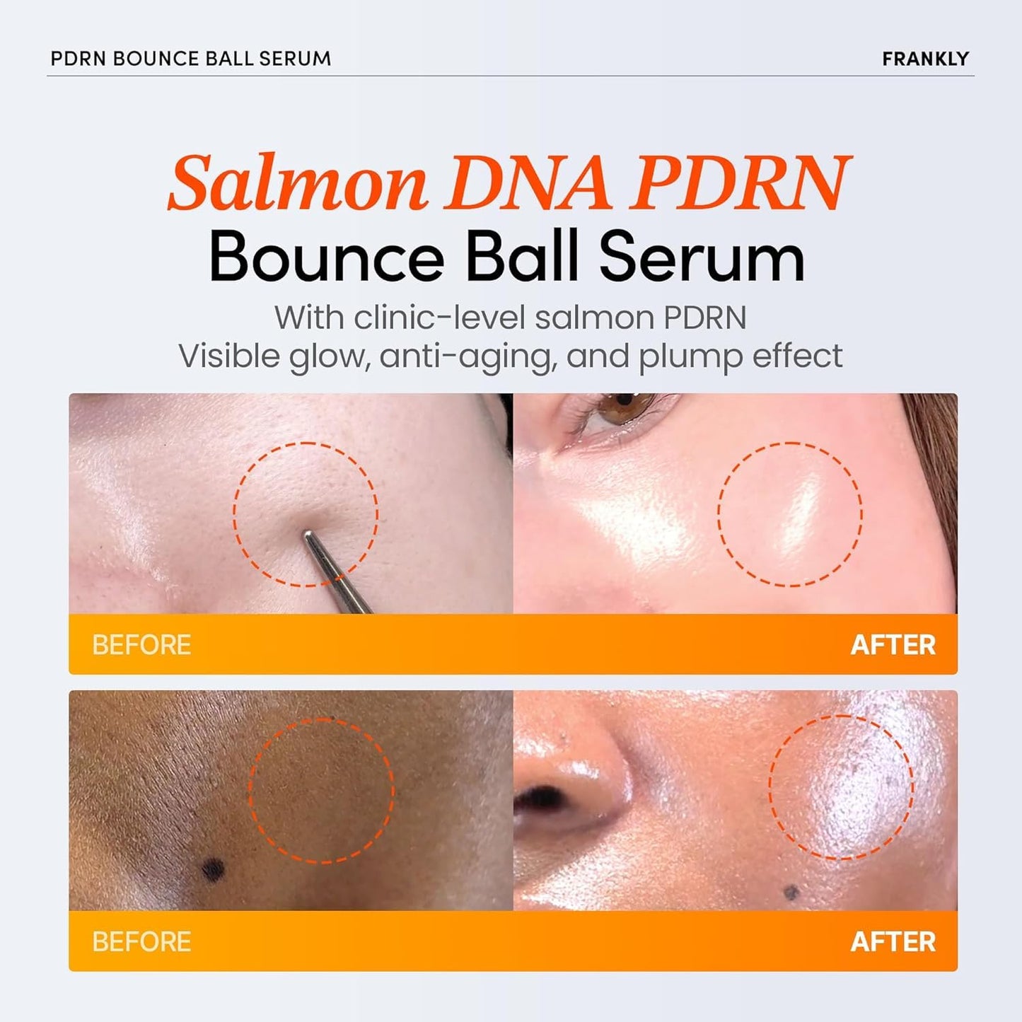 FRANKLY Salmon PDRN Bounce Ball Serum – PDRN Salmon DNA Serum for Plumping, Firming & Glass Skin | Glowing skin Booster | Lightweight, Non-Sticky Korean Skincare | 30mL