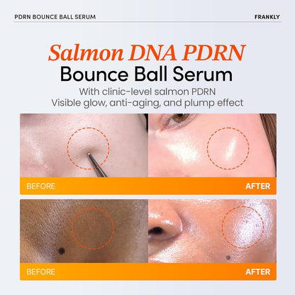 FRANKLY Salmon PDRN Bounce Ball Serum – PDRN Salmon DNA Serum for Plumping, Firming & Glass Skin | Glowing skin Booster | Lightweight, Non-Sticky Korean Skincare | 30mL