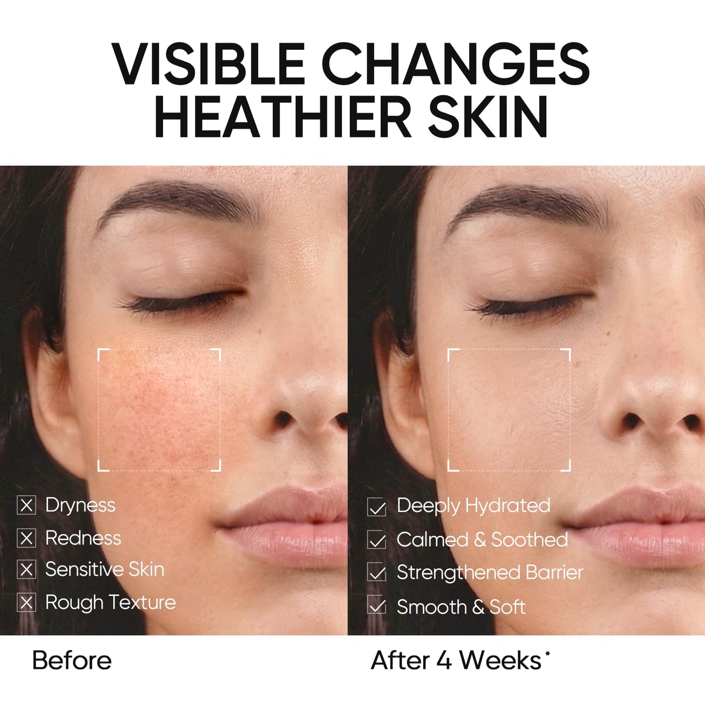 SKINTIFIC - 5X Ceramides Moisture Barrier Cream