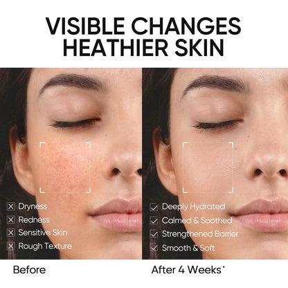 SKINTIFIC - 5X Ceramides Moisture Barrier Cream