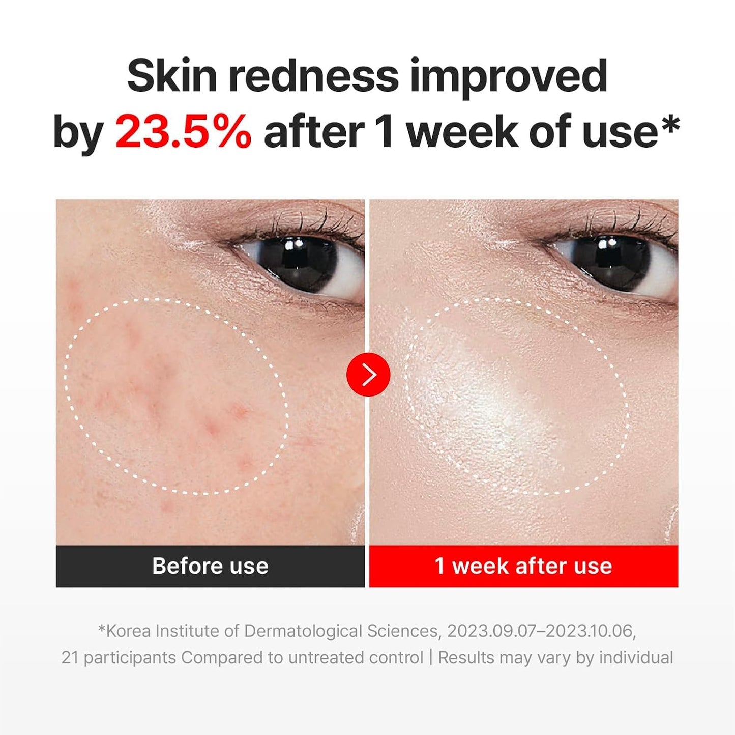 Centellian24 Time Reverse Madeca Cream