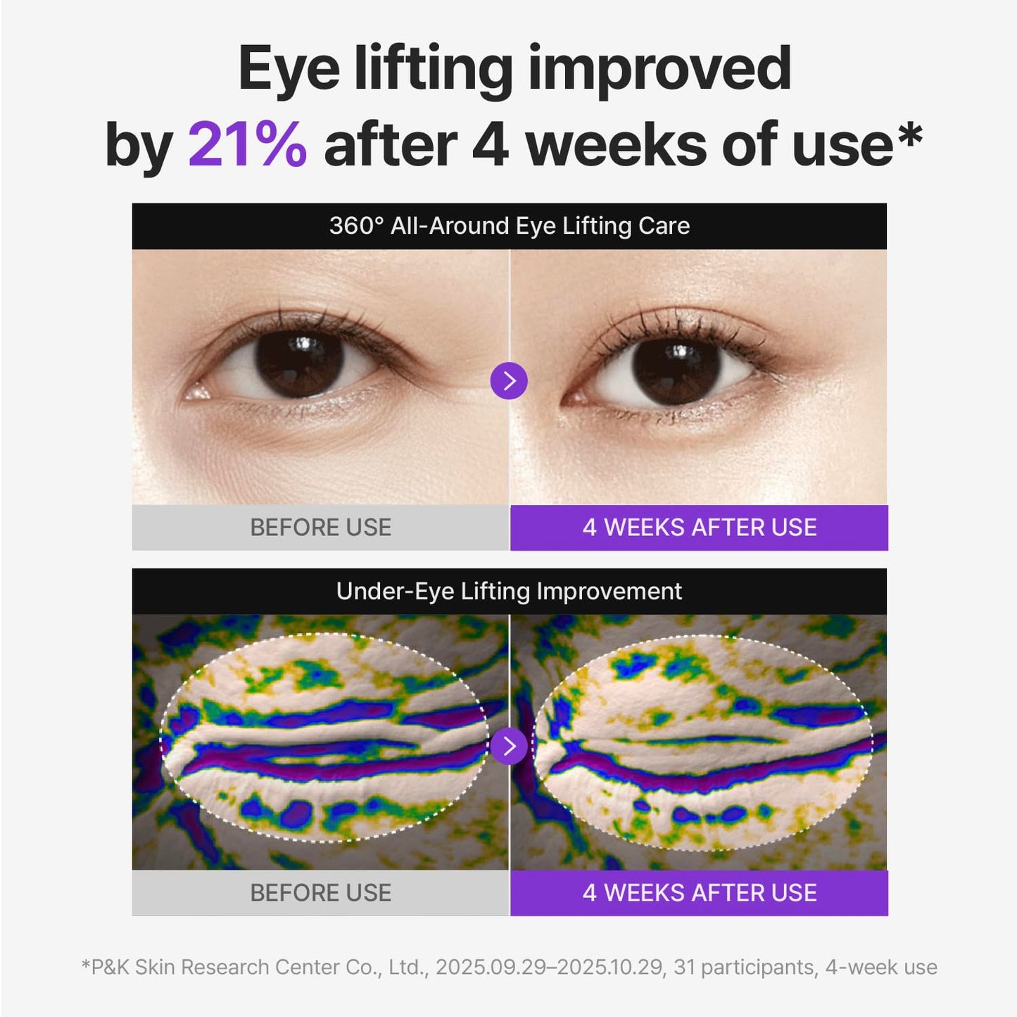 Centellian24-360º Shot PDRN lifting Eye cream 30ml
