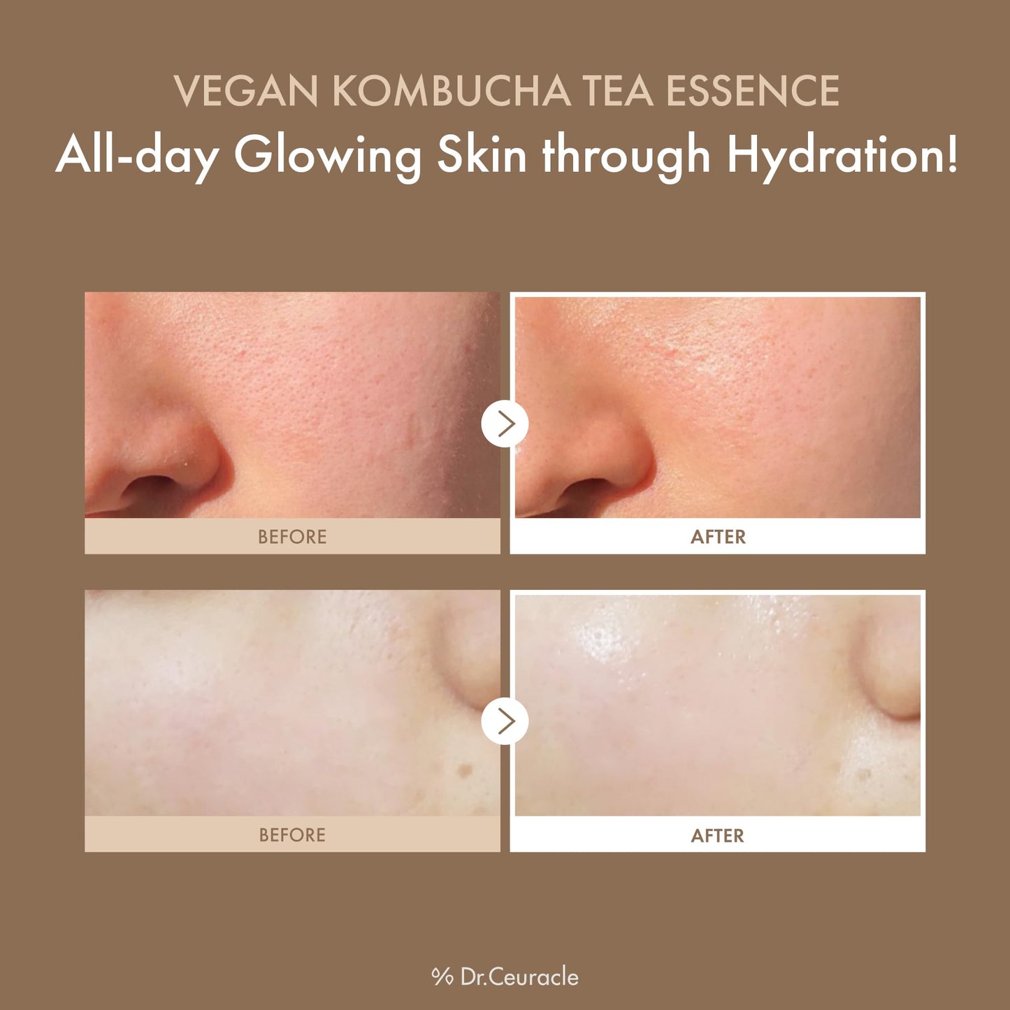 Dr.Ceuracle Vegan Kombucha Tea Gel Cream+Essence A hydrating vegan gel cream formulated with Kombucha Extract, a long-fermented black tea, leaving skin supple