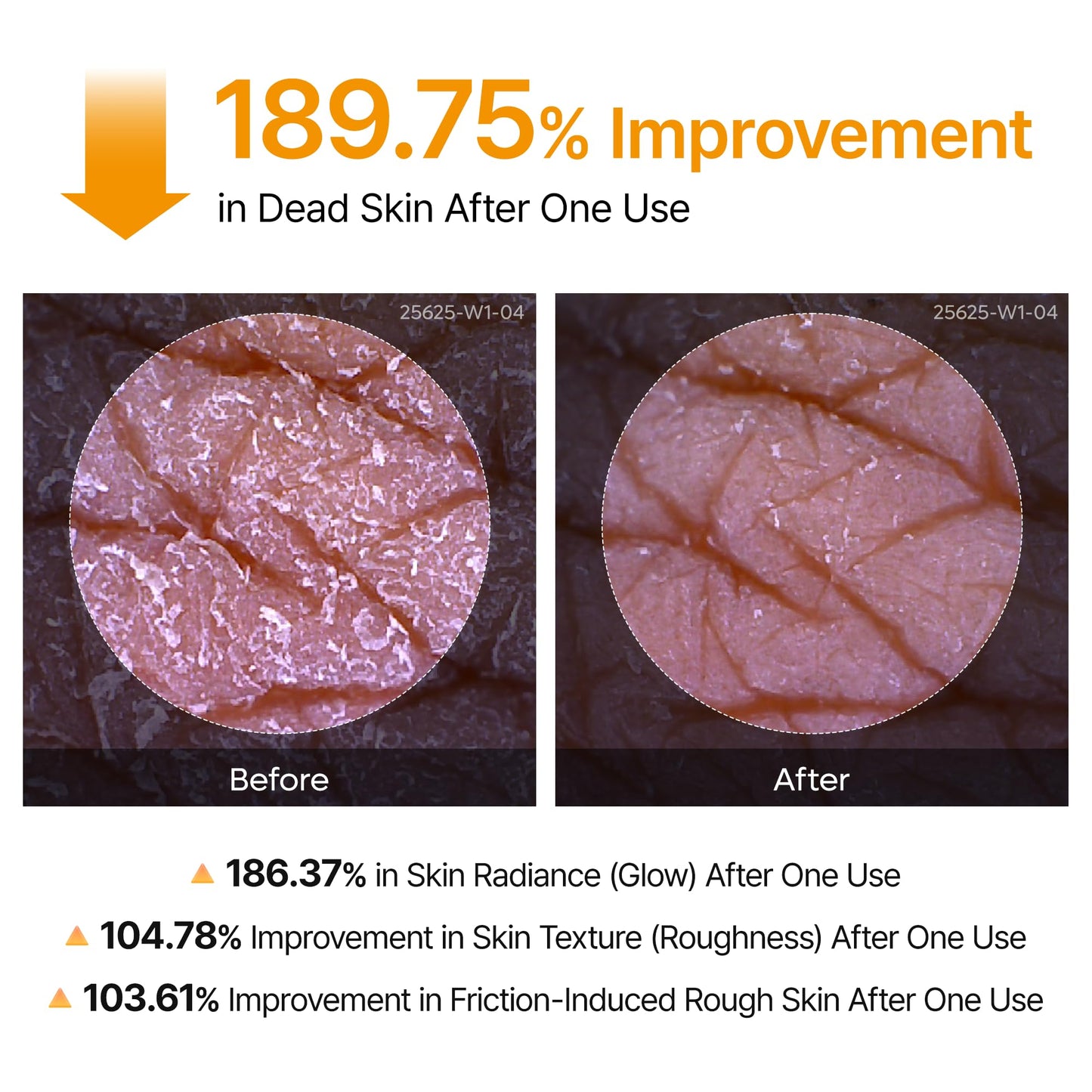 Dr.Melaxin Body Keratin Care Kojic Acid Turmeric Spray Gently Exfoliating Peeling Solution Korean Skincare All Skin Types 200ml