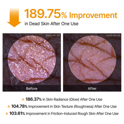 Dr.Melaxin Body Keratin Care Kojic Acid Turmeric Spray Gently Exfoliating Peeling Solution Korean Skincare All Skin Types 200ml