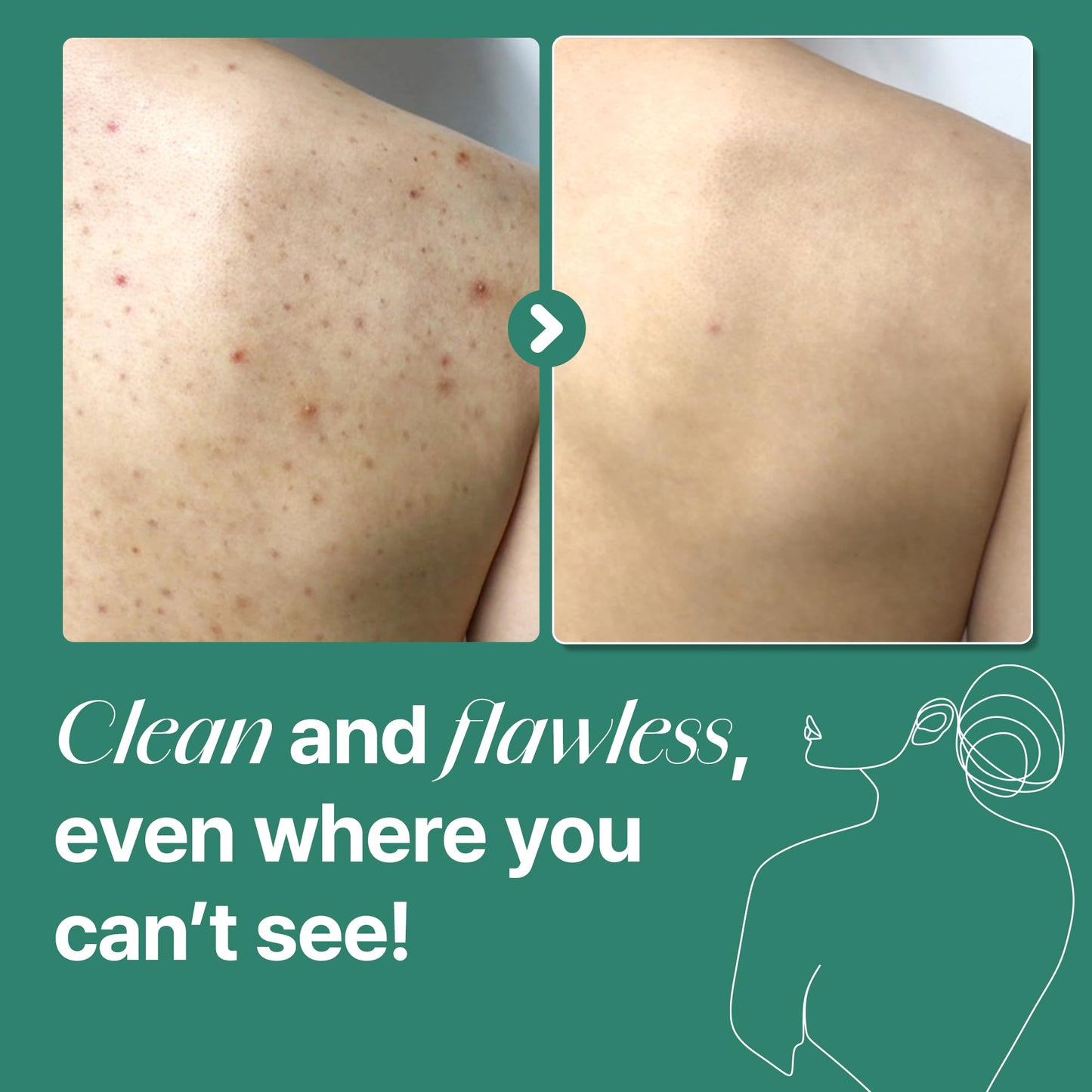 30 Days Miracle Clear Body Cleanser –
