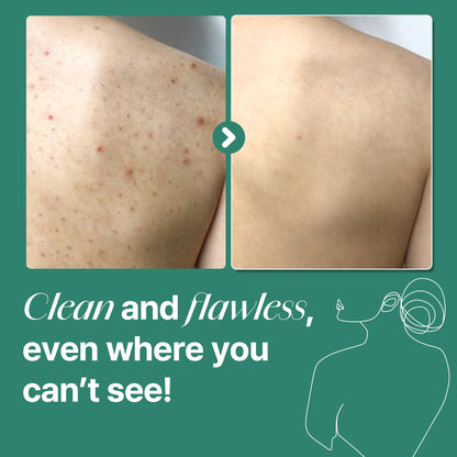 30 Days Miracle Clear Body Cleanser –